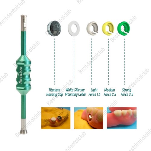 Novaloc inserti ritenzione - inserti,
