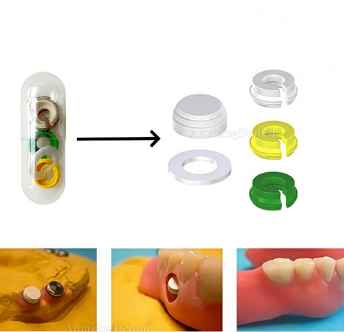 Novaloc tipo peek tappo - tipo,
